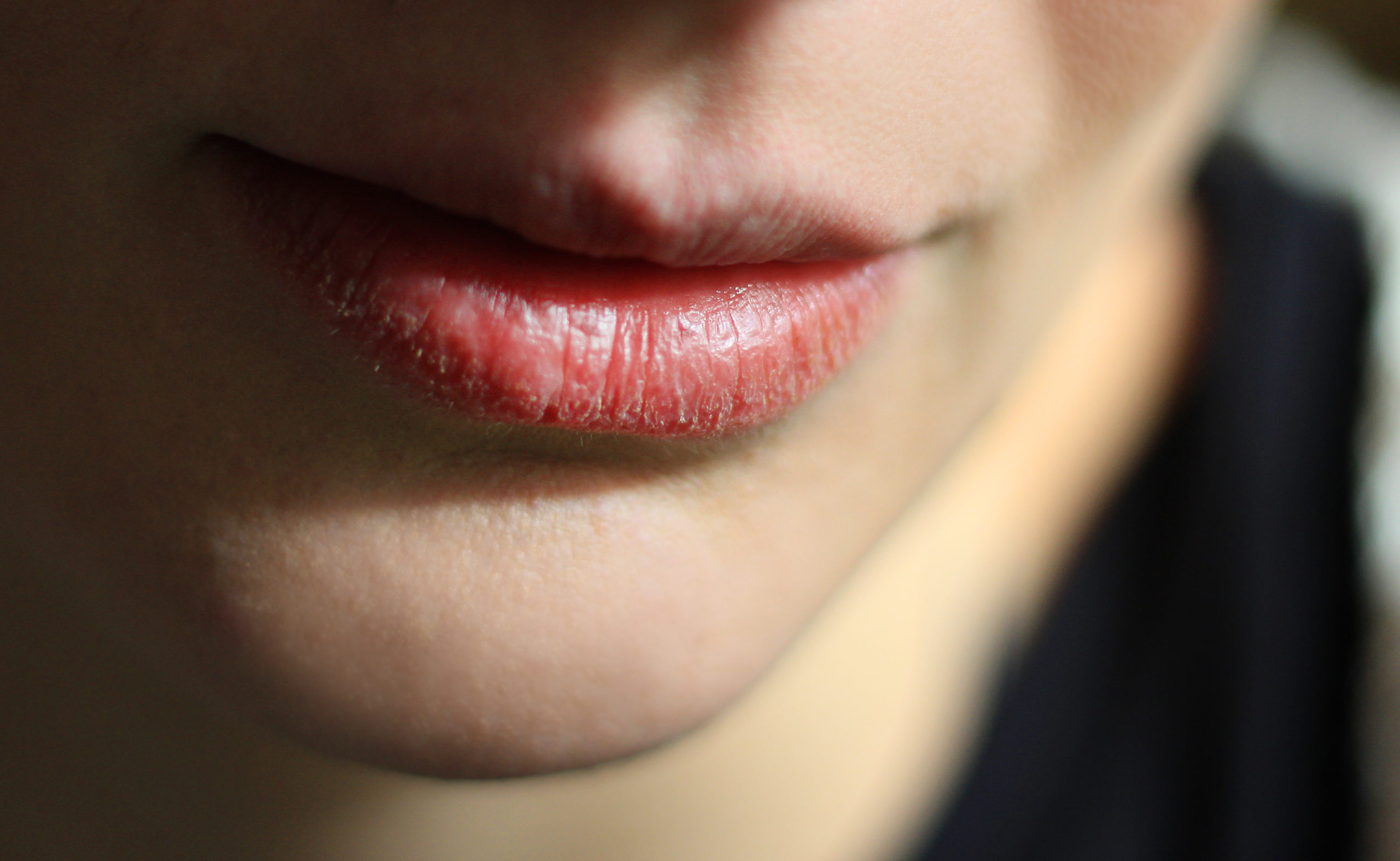 close up woman with dry lip home close up woman with dry lip home
